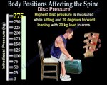 Body Positions Affecting the spine and discs - Everything You Need To Know - Nabil Ebraheim, M.D.
