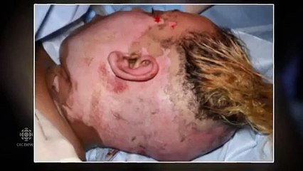 Cette femme a tatoué la moitié de son propre visage et la raison vous bouleversera!