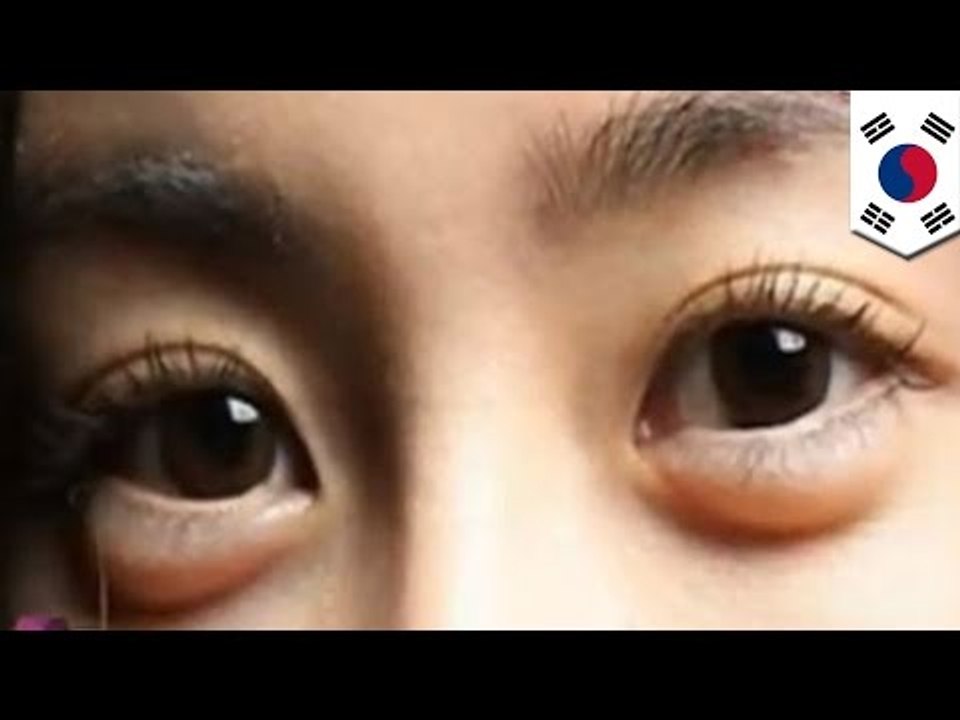 Korean beauty: Puffy eyes or 'aegyo-sal' is hottest new Korean fashion trend