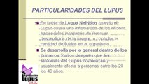 COMPLICACIONES DEL LUPUS ERITEMATOSO SISTÉMICO