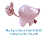 Right Dental Clinic For Dental Implants