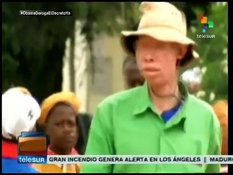 Niños albinos, víctimas de rituales de magia negra en Tanzania