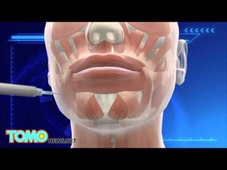 Mujer que viajo a Corea del Sur para realizarse cirugía plástica termina con sus labios inservibles