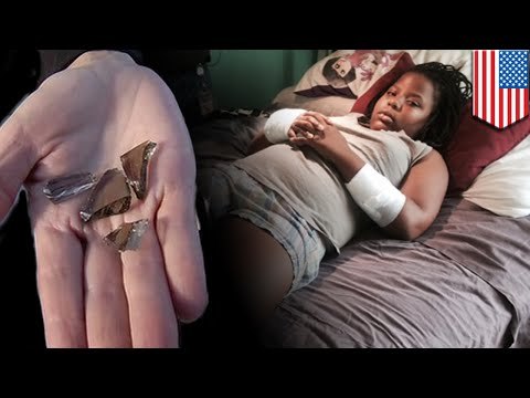 Девочка-гимнастка, прыгавшая на батуте, случайно вылетела в окно