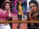 Top 10 Bollywood female stars celebrities before and after plastic surgery