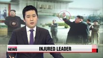 Photos indicate Kim Jong-un has injured his wrist