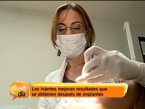 Injertos de hueso podrían ser la solución a muchos de sus problemas dentales
