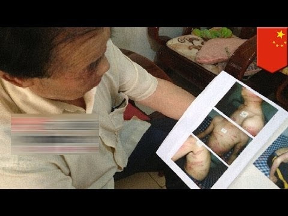 Жестокое обращение или экстремальное воспитание? Мать избила сына, не сделавшего домашнее задание