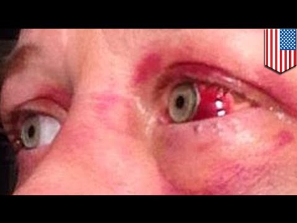 Шокирующие селфи в Facebook, опубликованные жертвой бытового насилия Энджелой Брауэр из Мемфиса