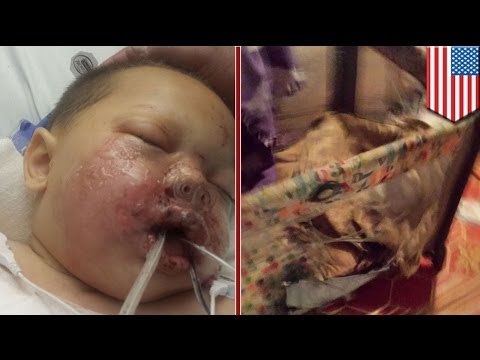 Ребёнок пострадал во время полицейского рейда