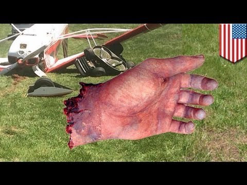 Джон Рафти лишился кисти руки из-за пролетавшего мимо самолета