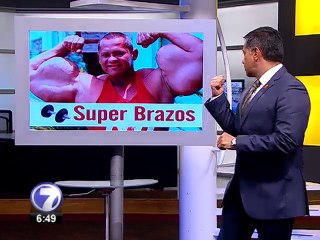 Brasileño aumenta sus músculos con inyecciones de aceite y alcohol