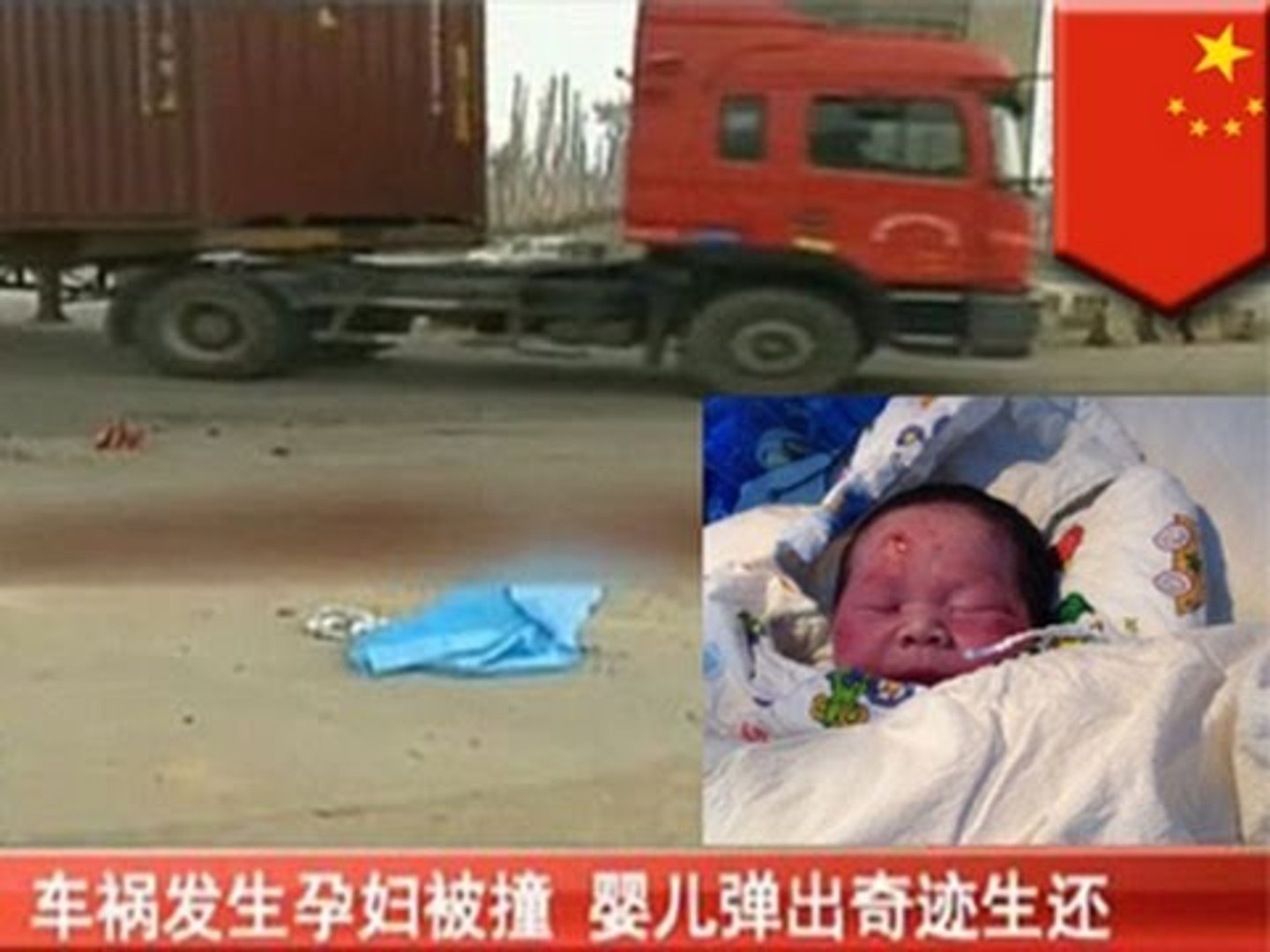 Малыш появился на свет после страшной аварии