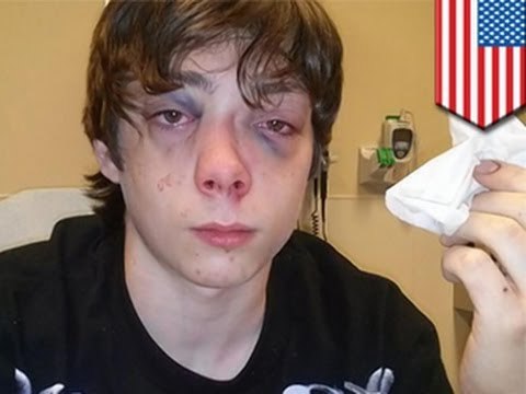 Подросток разбил лицо однокласснику