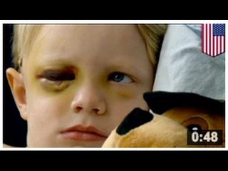 Un enfant est envoyé à l’hôpital après s’être fait frapper par une balle de baseball