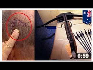 ARBALÈTE vs HACHE: Un homme se fait attaquer à l’arbalète et à la hache