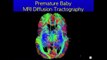 Advanced Imaging Techniques Improve Understanding of Newborn and Fetal Brain Development