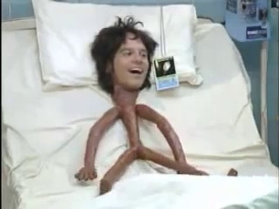 OMG!!! Thinnest Man in the World