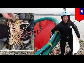 ロープが足に絡まった女性が出した驚きの依頼