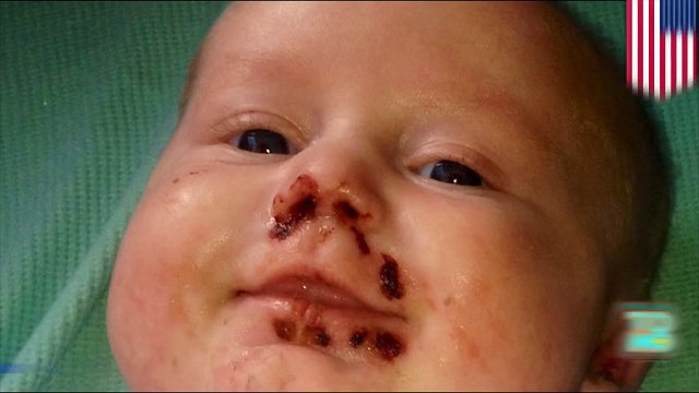 طفل يعلق تحت جثة أبيه لثلاثة أيام ينجو بحياته