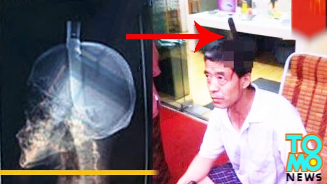 سكين يسقط ويستقر في رأس صيني في شارع غانغيوان