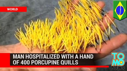 رجل ينقل إلى المشفى بعد إصابته ب 400 شوكة قنفذ