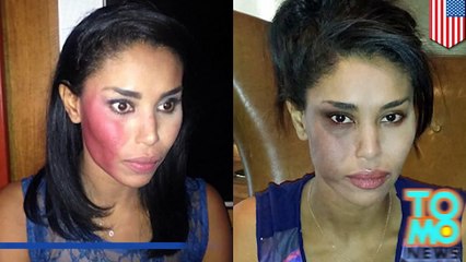 المعتدي على في ستيفيانو يسلم نفسه للشرطة