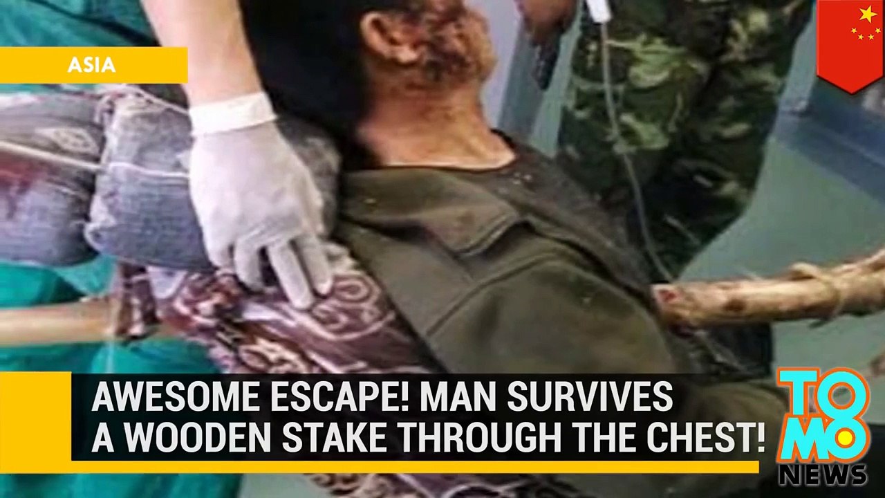 صيني ينجو من الموت بعد أن اخترق صدره جذع شجرة