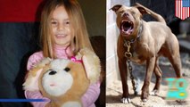 فتاة ينهشها كلب بيتبول يبلغ ضعفي حجمها ومن ثم تموت