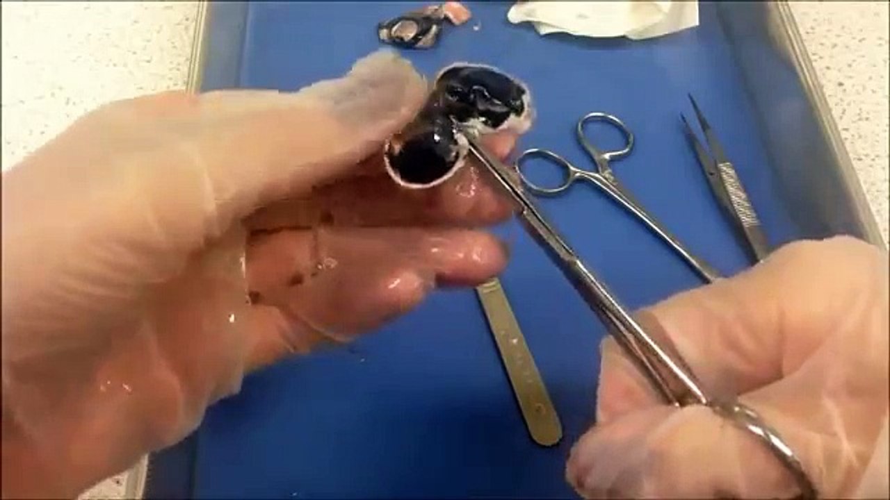 Eye Dissection