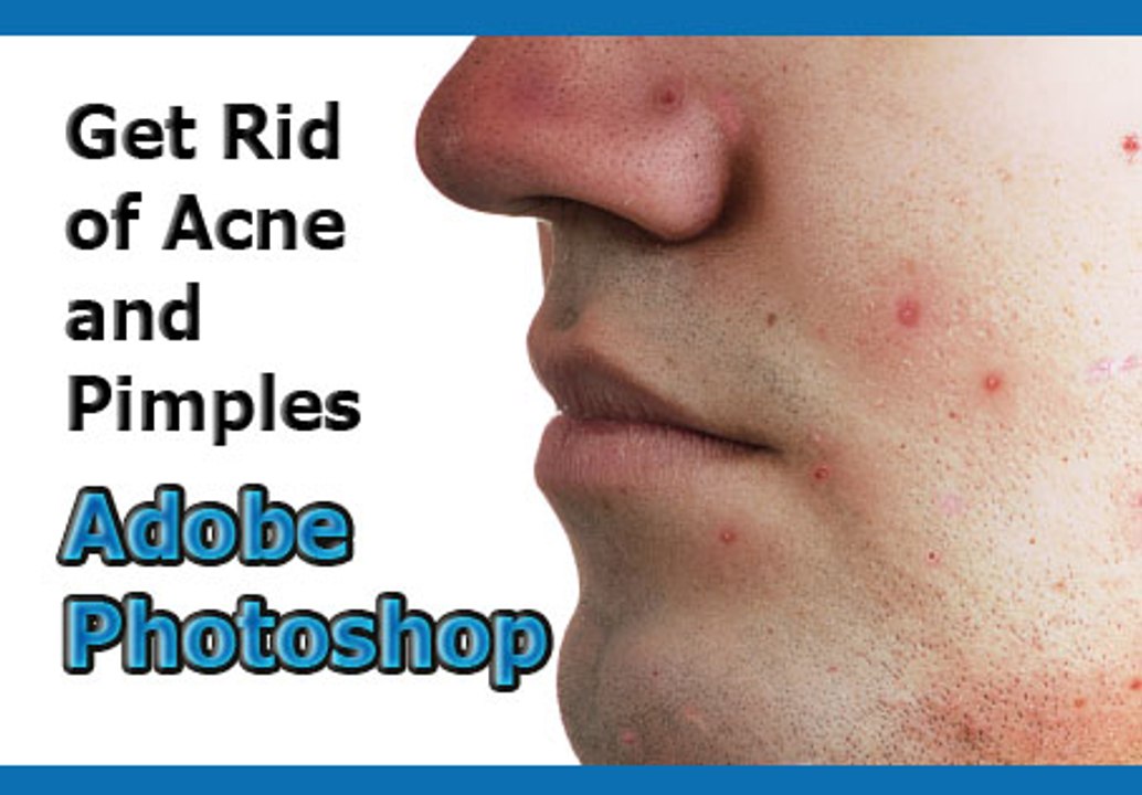 Adobe Photoshop Tutorial - How to Remove  Acne and Pimples