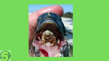 5 Most Horrible Parasites