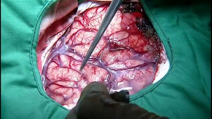 Language and the Brain (BBC, 2004)