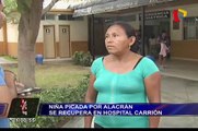 Niña picada por alacrán se recupera en hospital Cayetano Heredia