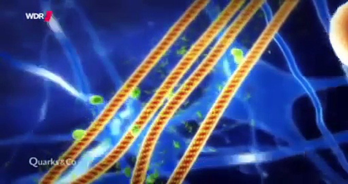 Quarks & Co  Demenz   wie wir uns vergessen und was wir dagegen tun können