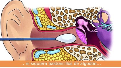 OMS:  El Cuidado del oído puede evitar la pérdida auditiva