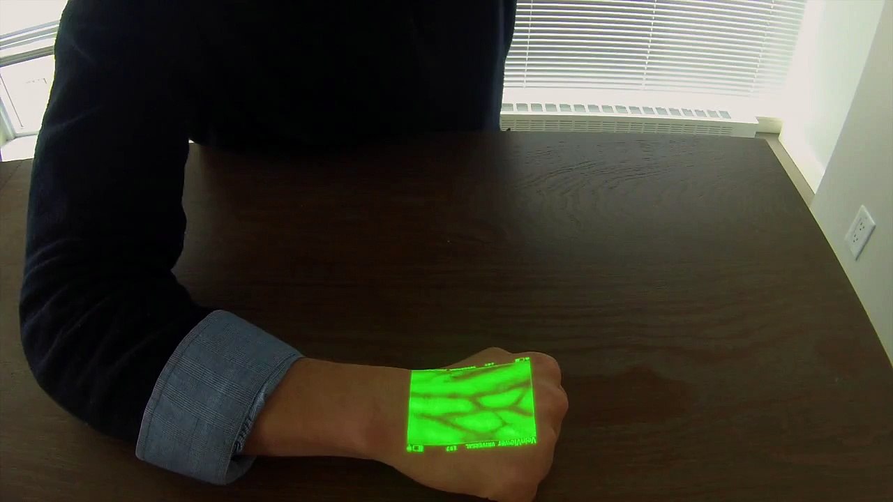 IV Vein Finder - VeinViewer Vision 2 - Modes for Higher IV Cannulation Success