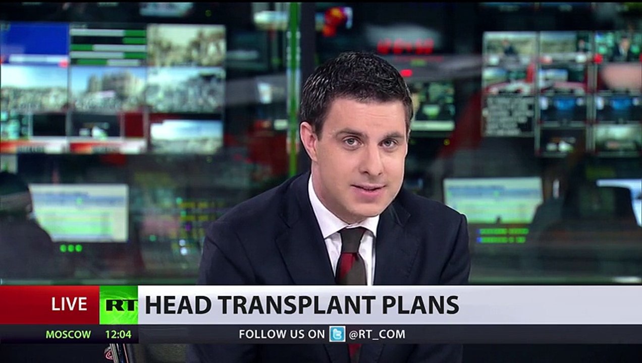 Revolutionary Russian man to undergo first head-to-body transplant, could experience a fate 'worse than death watch online now