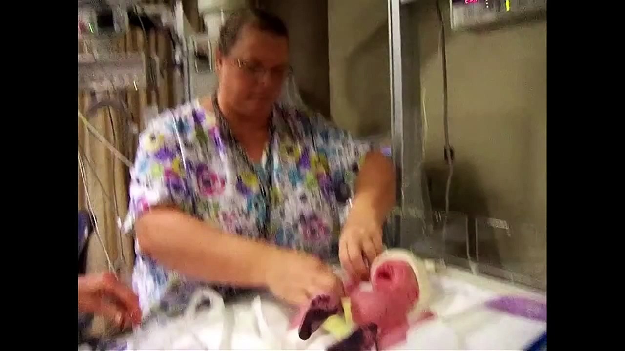 The Tin Man - Open Heart Surgery of an Infant - Arnold Palmer Hospital