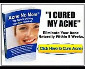 Mike Walden - 12 Michael Walden's Acne No More Reviews - Truly does It Function?