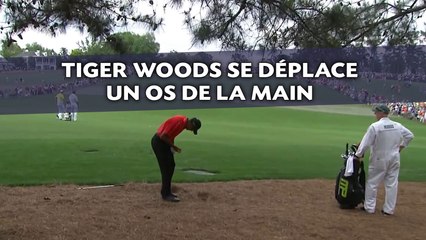 下载视频: Tiger Woods se déplace un os de la main en ratant un coup