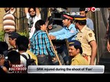 Shahrukh Khan injured during the shooting of film 'Fan'