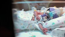 Emotivo video que muestra la supervivencia de un bebé prematuro conmociona las redes sociales