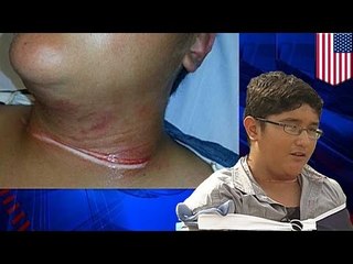 Niño en bicicleta casi pierde la cabeza luego de que un vecino atraveso una cuerda en su camino