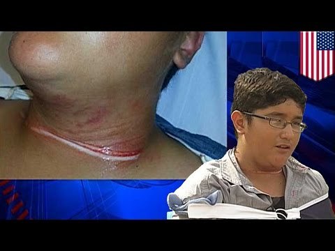 Niño en bicicleta casi pierde la cabeza luego de que un vecino atraveso una cuerda en su camino