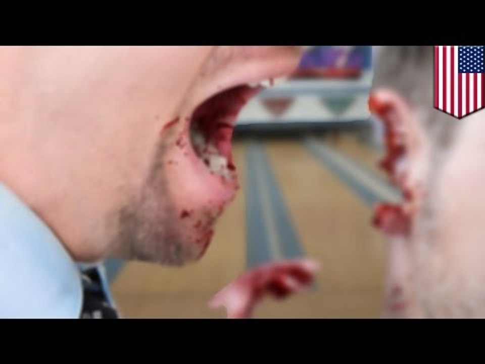 Pandillero le arranca de un mordisco la oreja a un hombre por culpa de una bebida derramada