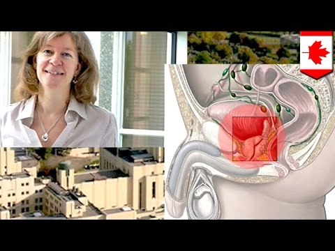 Investigadores afirman que tener varias parejas sexuales reduce el riesgo de cáncer de próstata