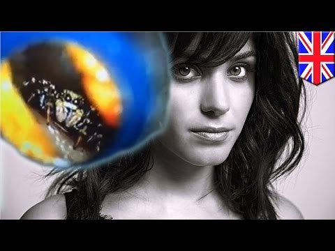 Estrella del pop Katie Melua tenia una pequeña araña viviendo en su oído interno