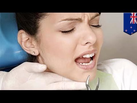 Hombre acusado de violación en Nueva Zelanda le arrancaba a sus victimas los dientes con alicates