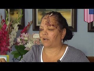 Abuela y su nieto son atacados por una nutria en un rio de Washington